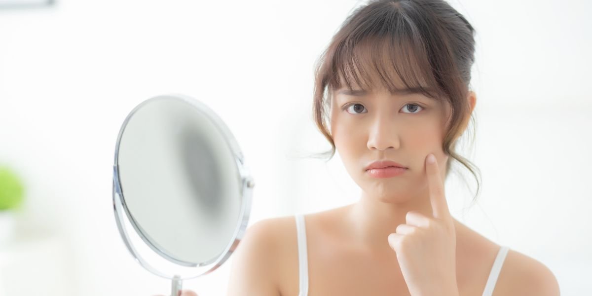 How Can I Prevent and Treat Acne Breakouts? How Can I Prevent and Treat Acne Breakouts?